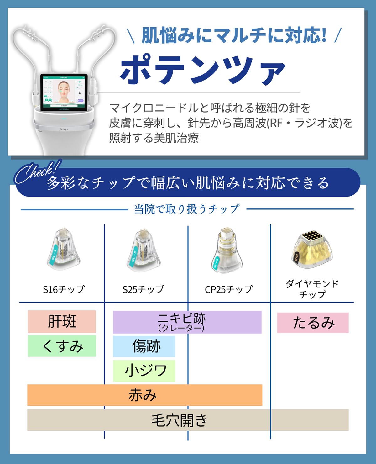 ポテンツァ