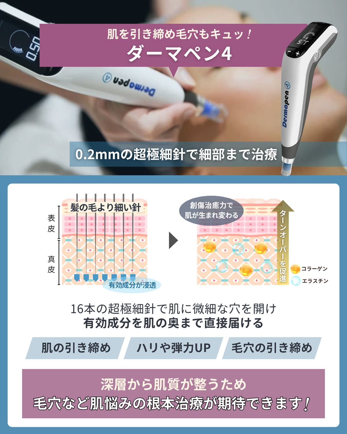 ダーマペン4
