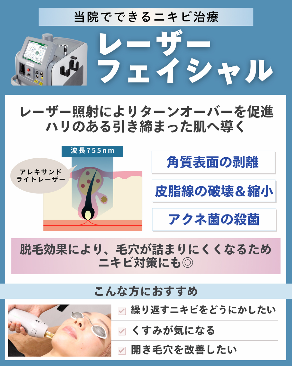 レーザーフェイシャル