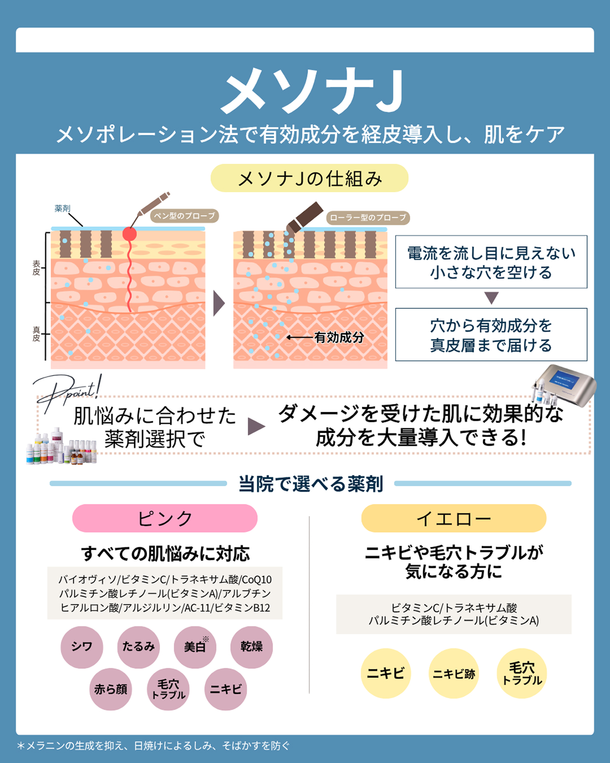 メソナJ