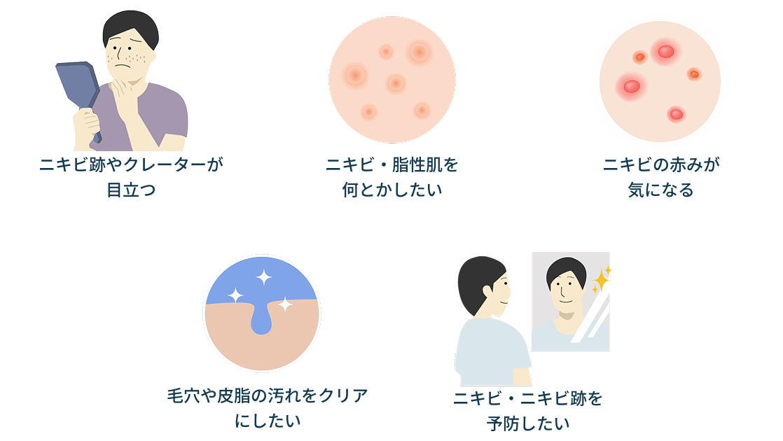 ニキビのお悩み