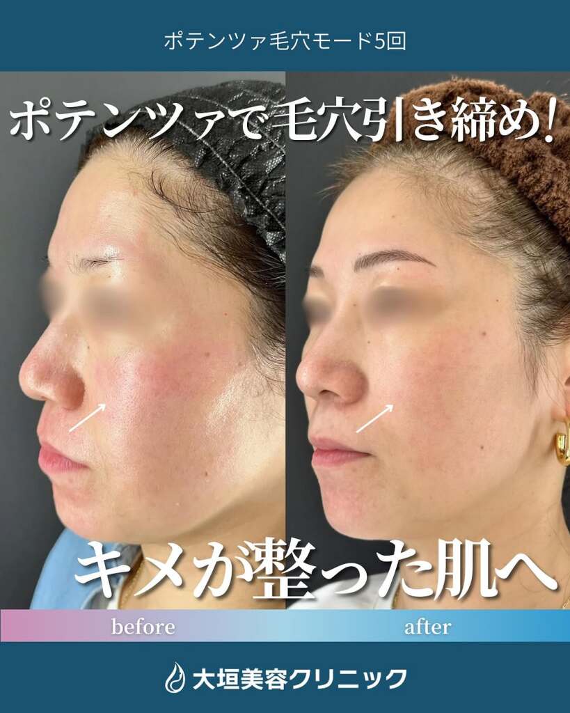 ポテンツァ