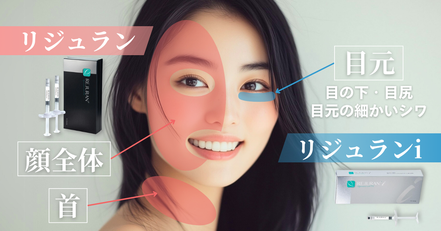 リジュラン