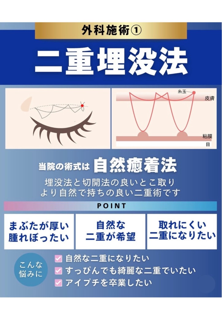 大垣市で叶う、キレイな二重瞼✨