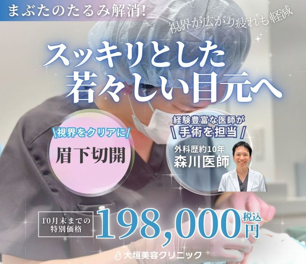 眉下切開