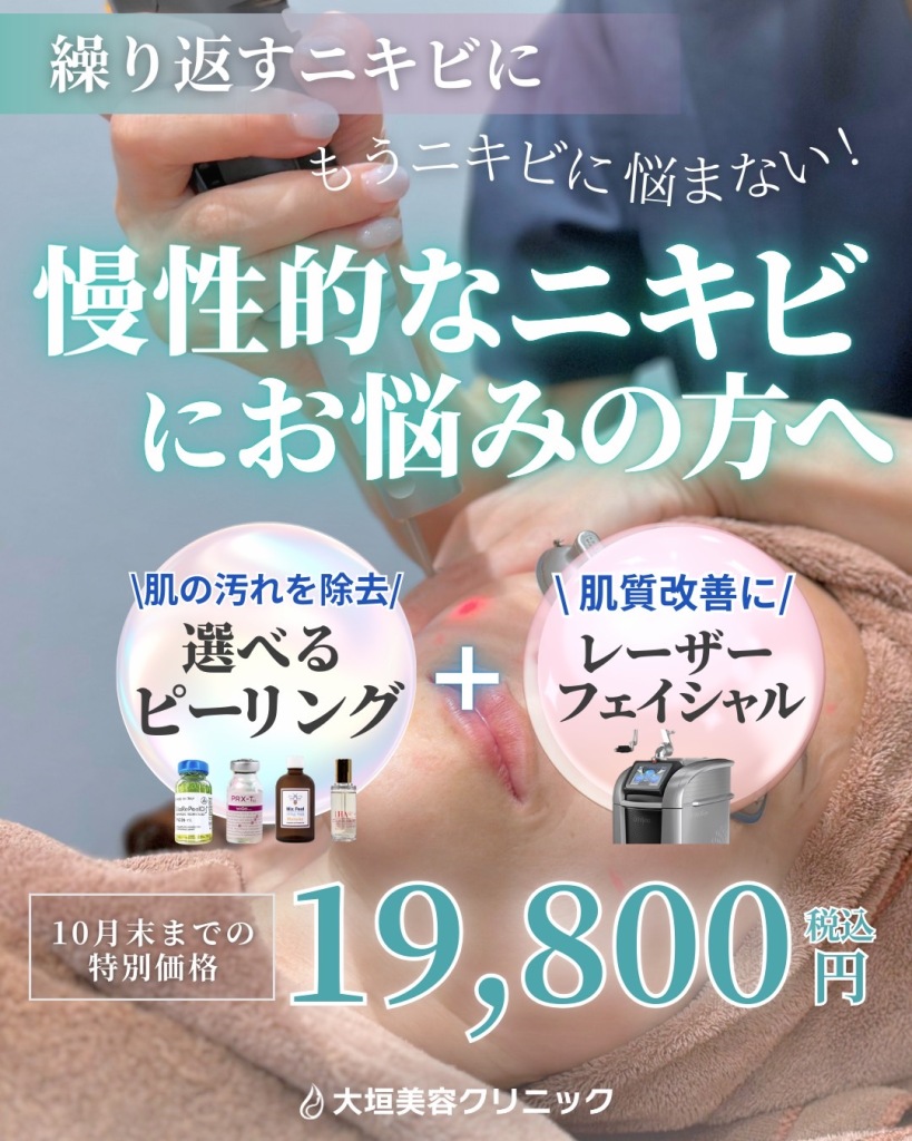 岐阜でピーリング+レーザーフェイシャルを受けるなら大垣美容クリニック!!