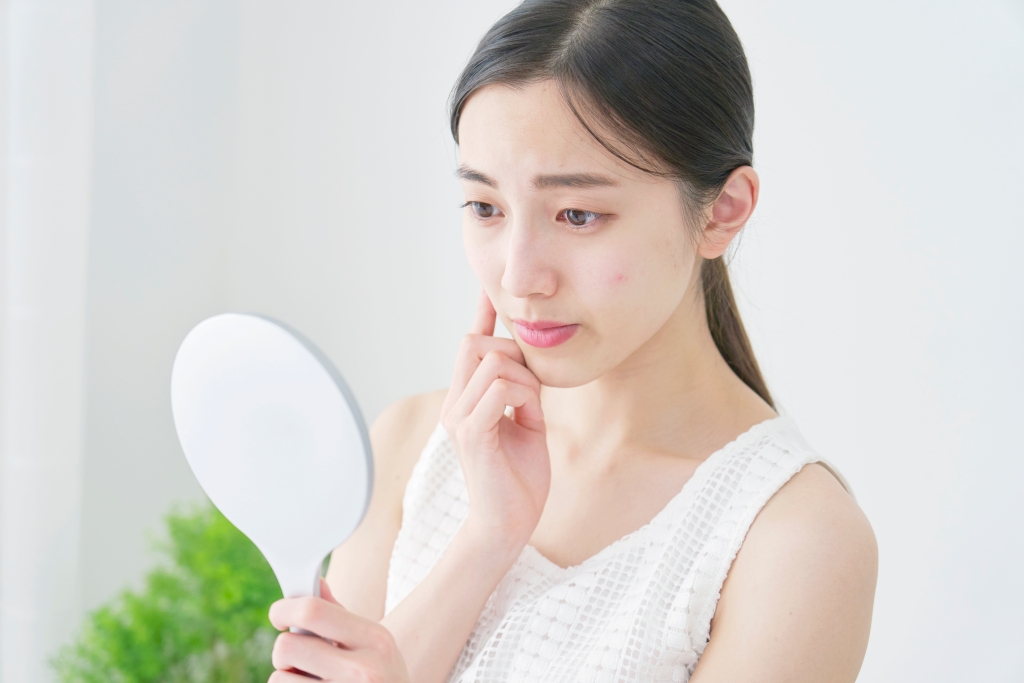 【岐阜でニキビ治療】皮膚科と美容皮膚科の違いは?原因やニキビケアの種類も紹介