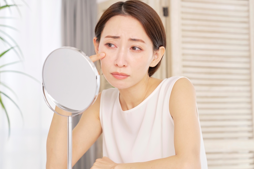 目の下のたるみが気になる方へ|岐阜の大垣美容クリニックが原因や対処方法、たるみに効く施術の種類を解説
