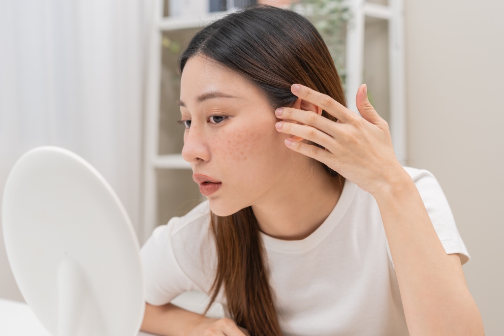 【シミ取りを岐阜でお考えの方へ】後悔しない美容医療と大垣美容クリニックのご紹介