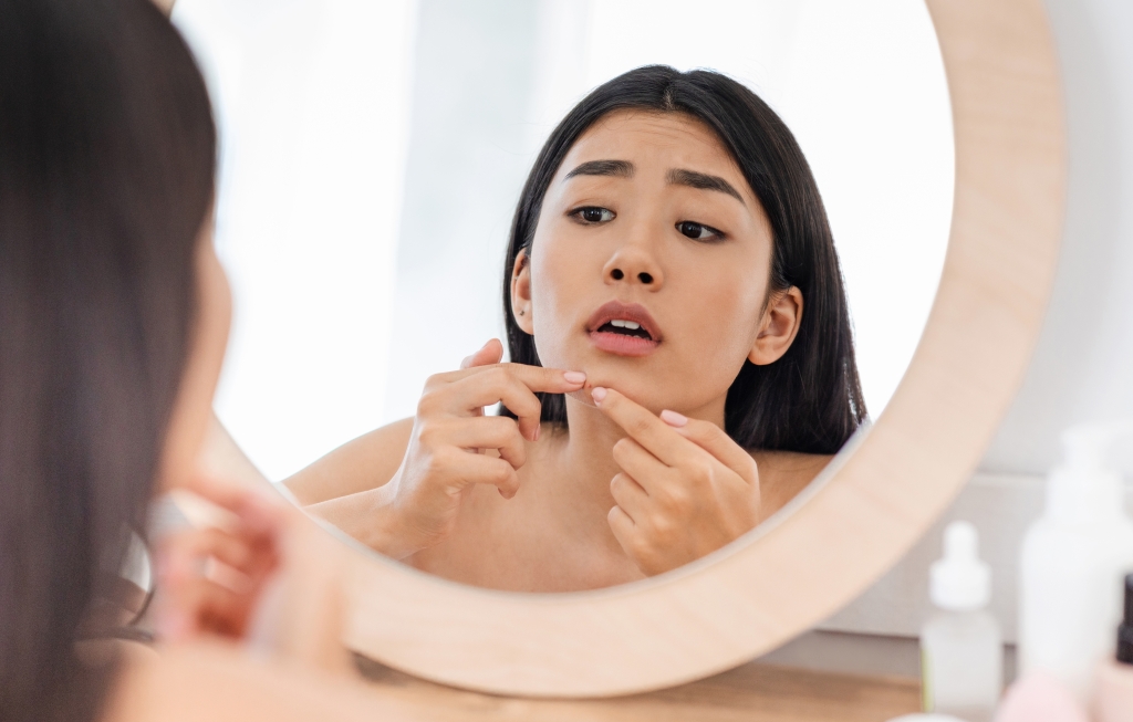 【岐阜でニキビ治療】皮膚科と美容皮膚科の違いは？原因やニキビケアの種類も紹介｜大垣美容クリニック
