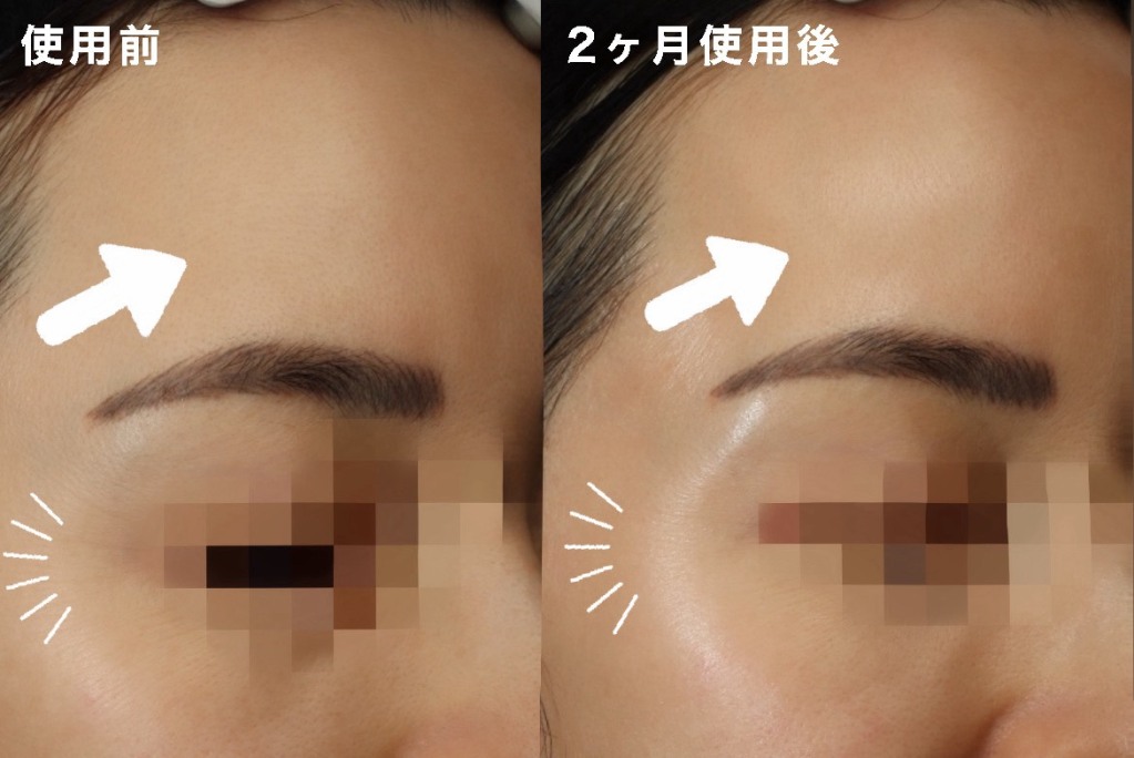 岐阜でツヤ肌を目指す方におすすめにのホームケア💙