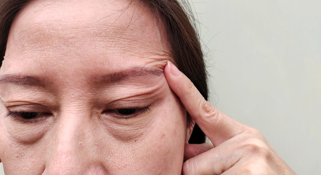 目元　岐阜市で眼瞼下垂治療をお考えの方へ|"目が開けにくい""疲れて見える"などのお悩みを解消する方法｜大垣美容クリニック