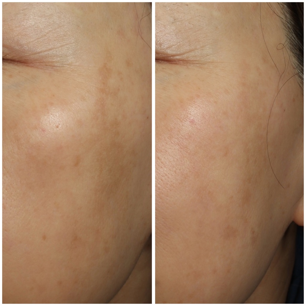 2026年も、内服について熱く語り続けるカウンセラーE🐼