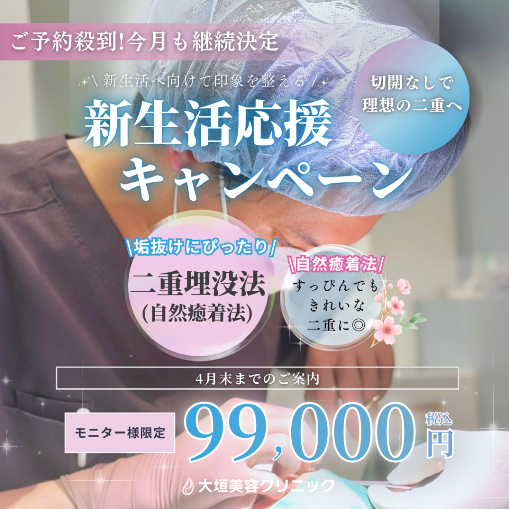 【４月限定】新生活応援キャンペーン 二重埋没法 99,000円