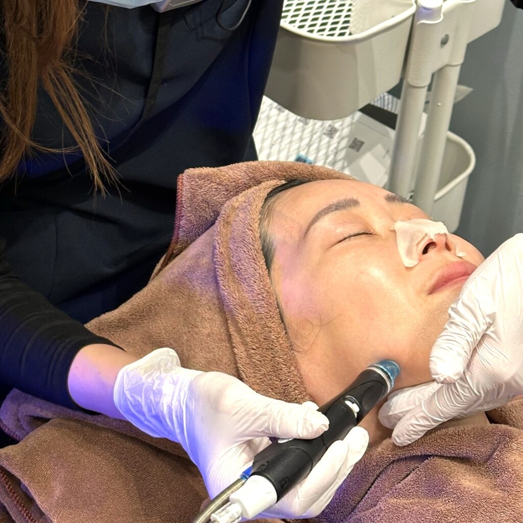 ハイドラフェイシャル