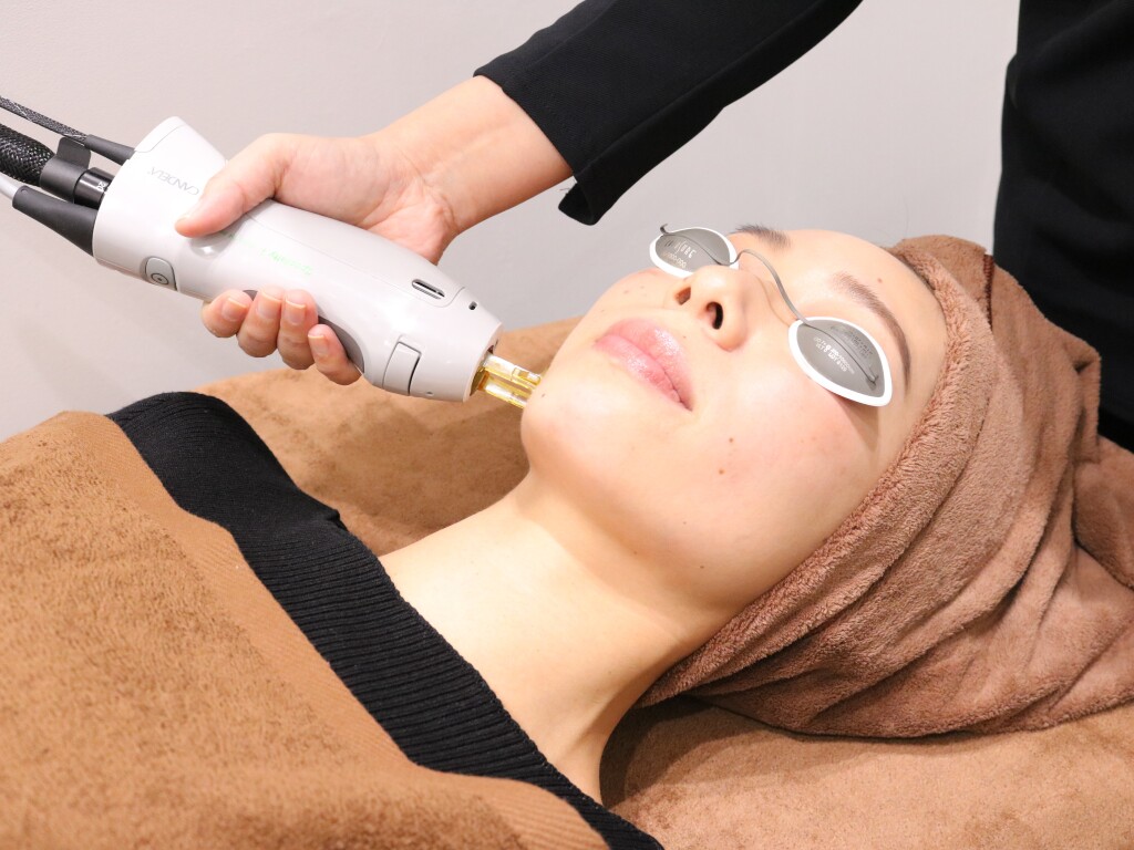 岐阜でそばかすの治療を考えているなら知っておきたいこと｜美容医療で叶える本格アプローチ｜岐阜・大垣市の美容皮膚科・脱毛の大垣美容クリニック