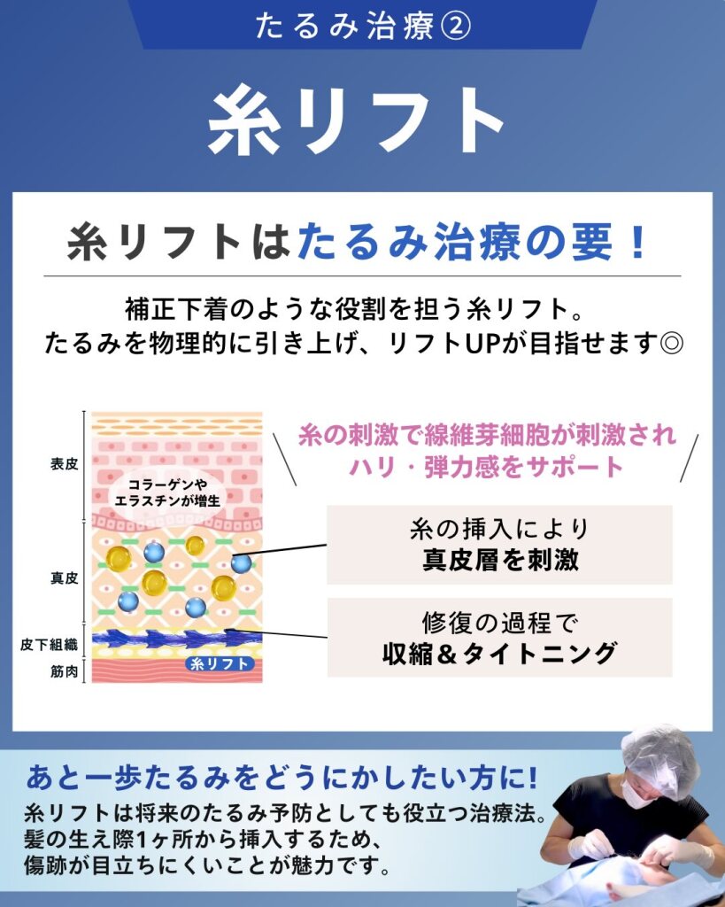 大垣美容クリニックの糸リフトのInstagram