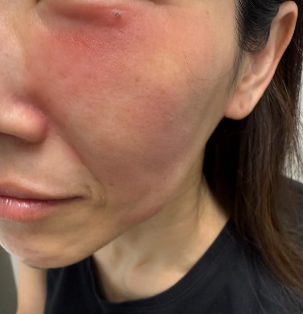 🚨ミラミンを使う前に、知っておいてほしいこと