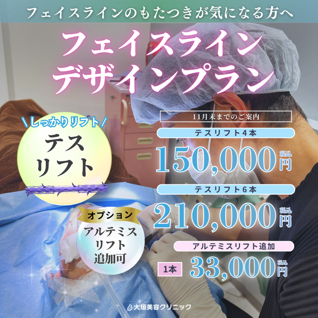 【11月限定】フェイスラインデザインプラン｜テスリフト4本 150,000円〜