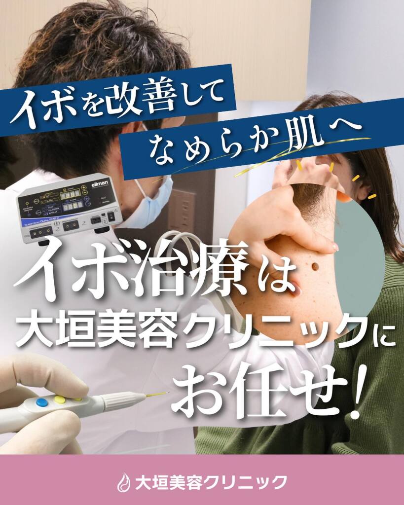 サージトロン（いぼ取り・ほくろ取り）